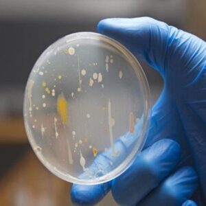 MICROBIAL CULTURE